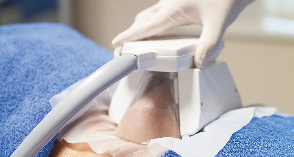 How Fat Freezing and HIFU Work Together? 2 Multiple Areas in One Session HIFU and Fat Freezing Harrow
