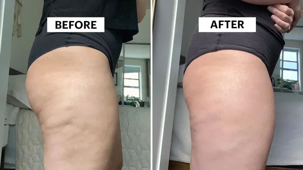 Do Toning Exercise Harrow Really Tackle Cellulite?