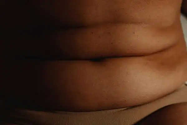 The Hidden Connection: How Stress Shapes Your Fitness and Body Composition 3 image of what stress can do on the stomach area and how Lipo 360 Harrow can help to change your body shape.